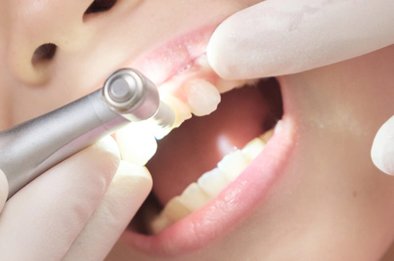 歯科衛生士によるお口のクリーニング